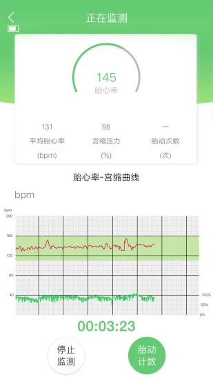 喜芽(胎心监护仪)