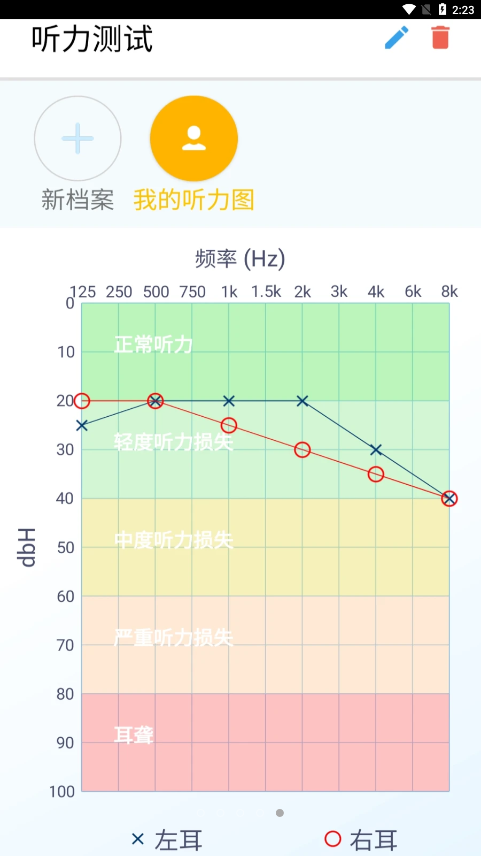 艾米助听下载APP