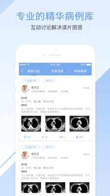 医学影像