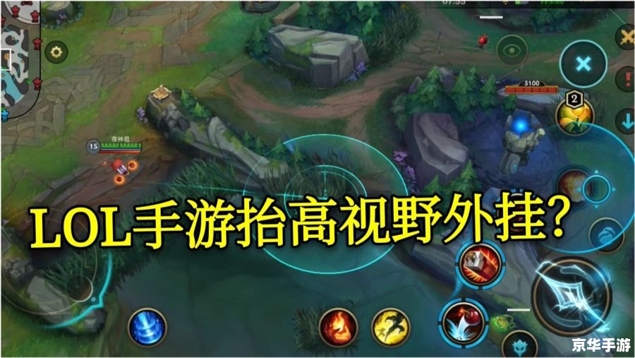 LOL道具:提升游戏体验的关键元素 LOL道具:提升游戏体验的关键元素