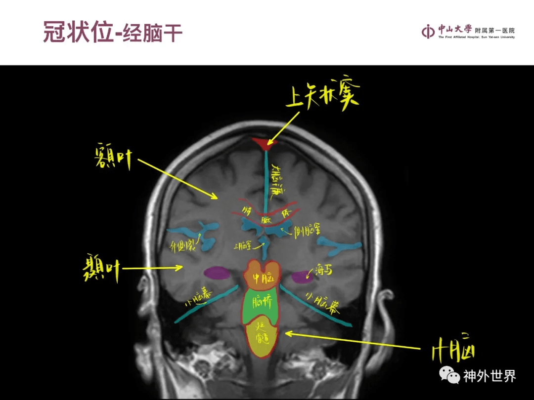 电车之狼r怎么保存 电车之狼r保存方法详解 电车之狼r怎么保存 电车之狼r保存方法详解